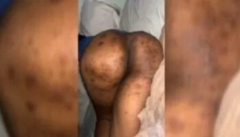 Hannah Yansh Leak Sextape Tape On X and Instagram